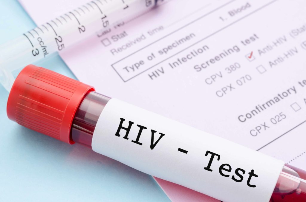 national-hiv-testing-day-june-27