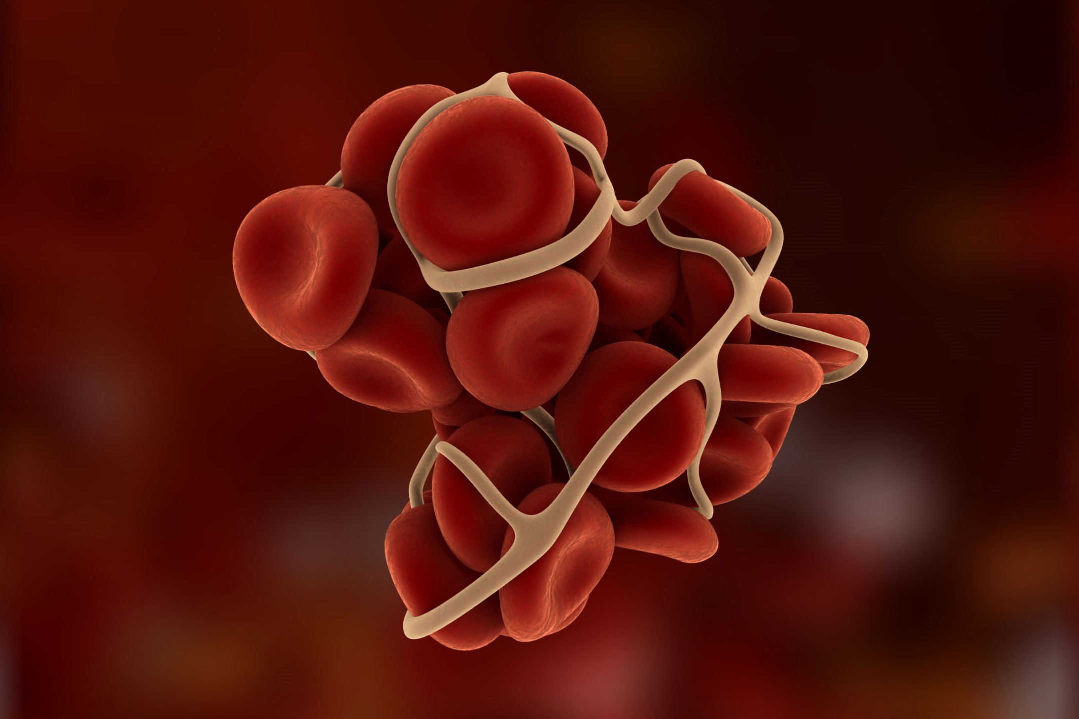 World Hemophilia Day April 17