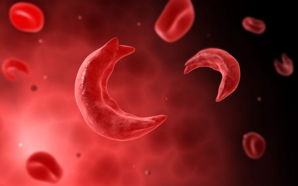 world-sickle-cell-day-june-19